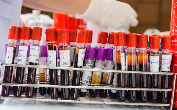 Крвните групи и Бомбајската енигма